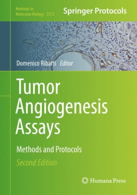 Tumor Angiogenesis Assays