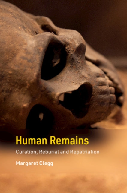 Cambridge Texts in Human Bioarchaeology and Osteoarchaeology