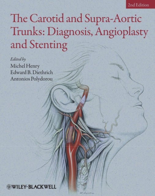 Carotid and Supra-Aortic Trunks