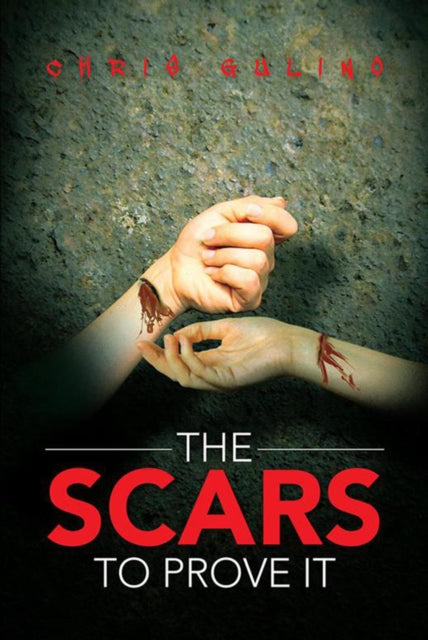 Scars to Prove It