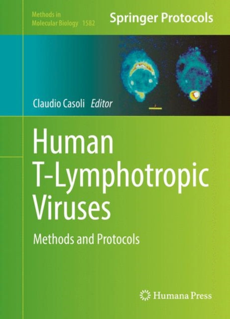 Methods in Molecular Biology