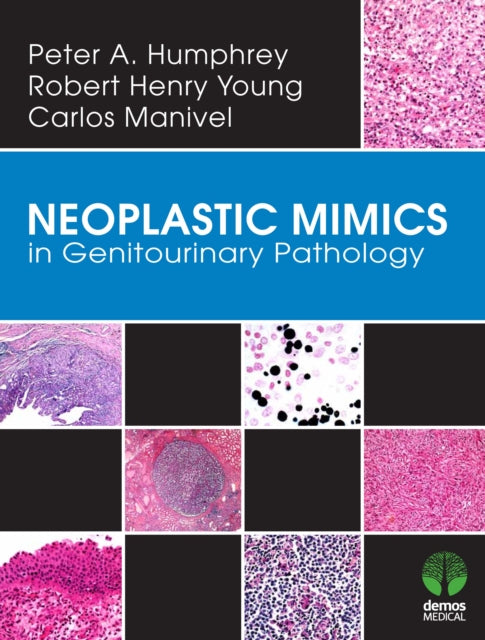 Neoplastic Mimics in Genitourinary Pathology