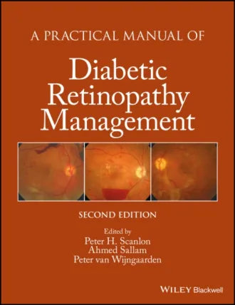 Practical Manual of Diabetic Retinopathy Management