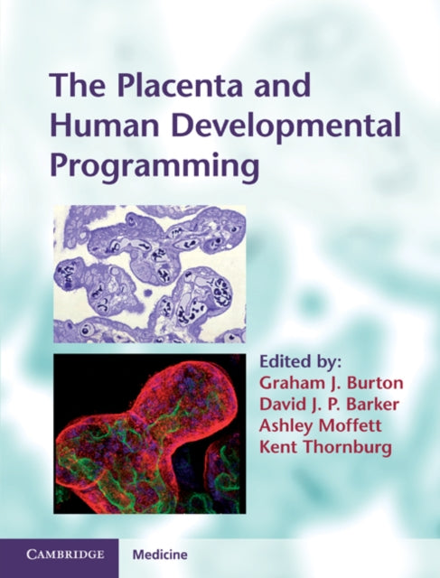 Placenta and Human Developmental Programming