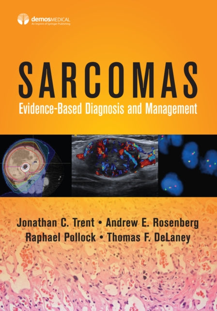 Sarcomas