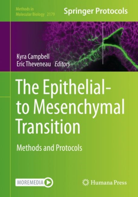 Epithelial-to Mesenchymal Transition