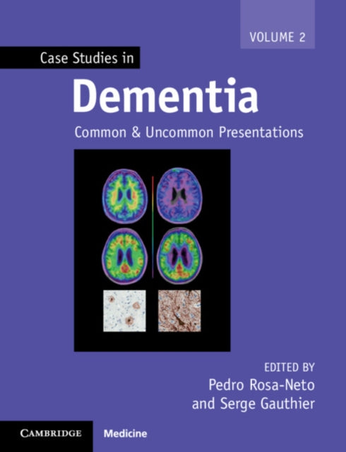 Case Studies in Neurology