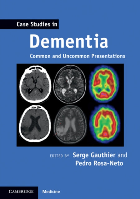 Case Studies in Neurology