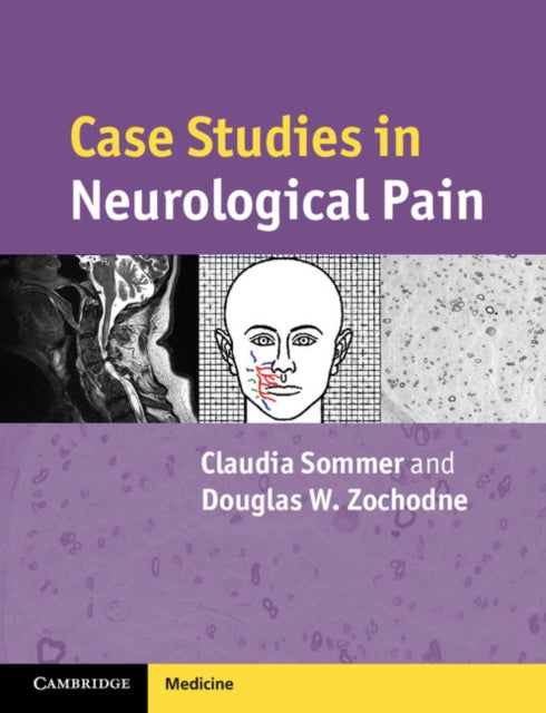 Case Studies in Neurology