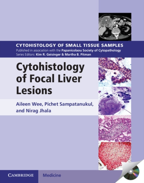 Cytohistology of Small Tissue Samples