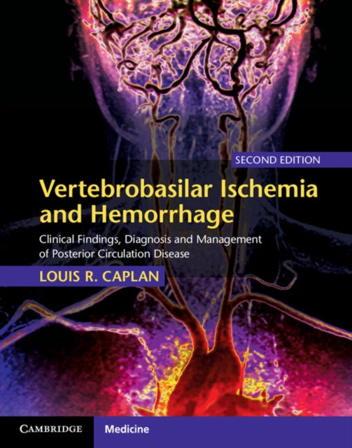 Vertebrobasilar Ischemia and Hemorrhage