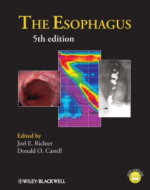 Esophagus