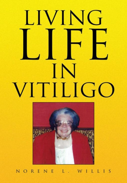 Living Life in Vitiligo