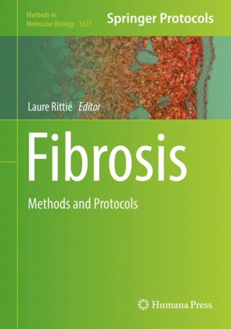 Fibrosis