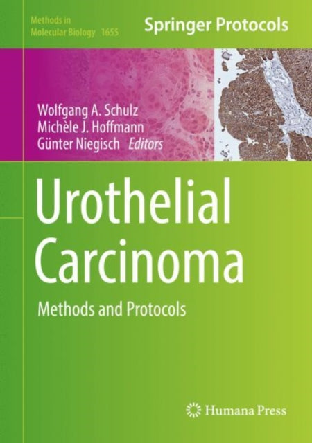 Urothelial Carcinoma