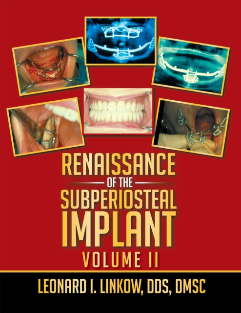 Renaissance of the Subperiosteal Implant