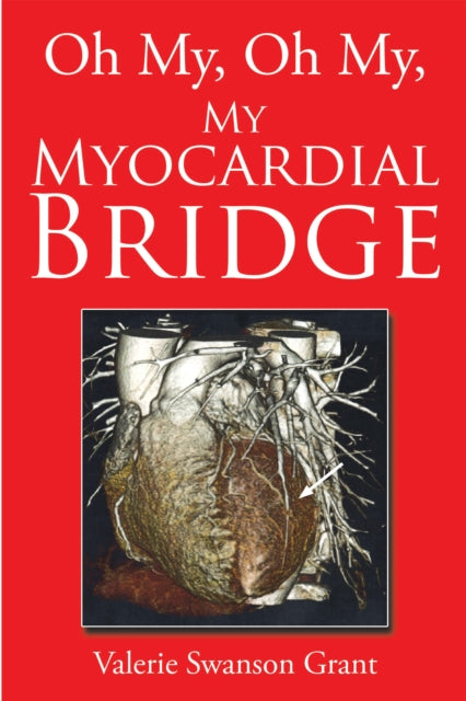 Oh My, Oh My, My Myocardial Bridge