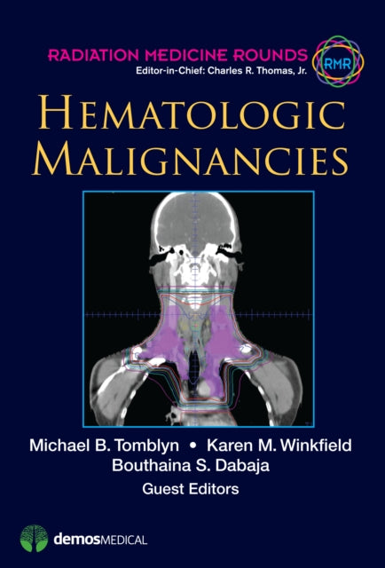 Hematologic Malignancies