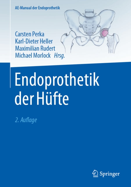 AE-Manual der Endoprothetik